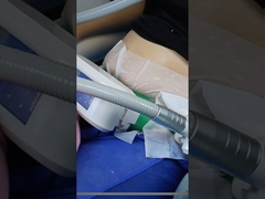 Já tentaste congelar gordura para perder peso?