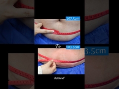 Congela a gordura, perde 4 cm em 1 hora!