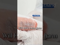 A HIFU causará danos?