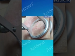 HIFU versus CO2 Laser, que tratamento anti-envelhecimento você prefere?