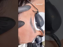 Nd Yag Laser para remoção de tatuagens de sobrancelhas #ndyaglaser #tattooremovallaser #beautymachine #laserclinic