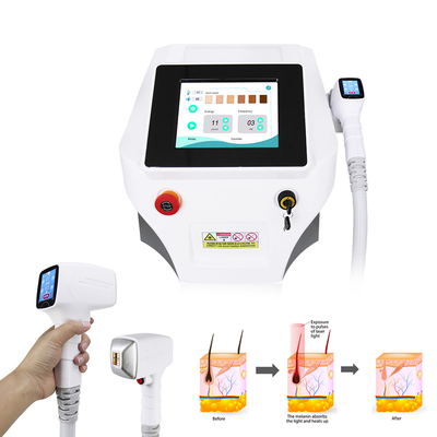 Onda permanente 808nm de Nova Ice Diode Laser Machine 3 da remoção do cabelo